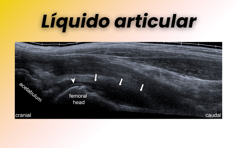 1. Patologia compartimento anterior cadera tempo formacion.png